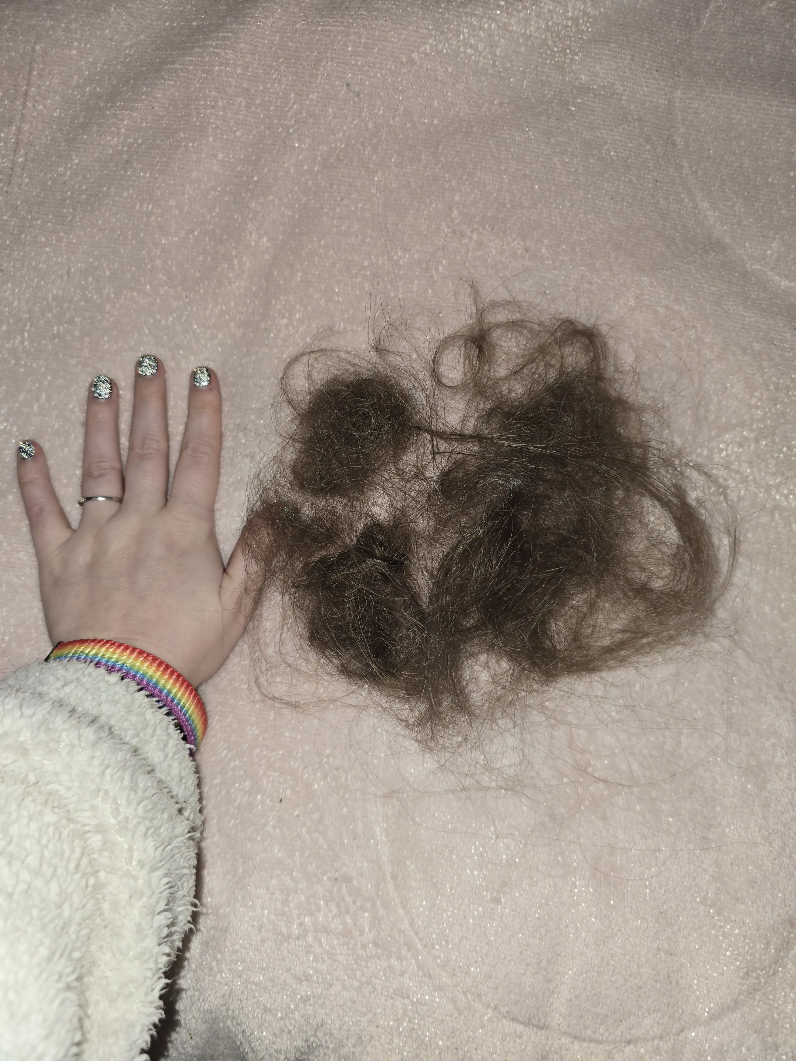 Aimee's hair started to come out in chunks (Kennedy News and Media)