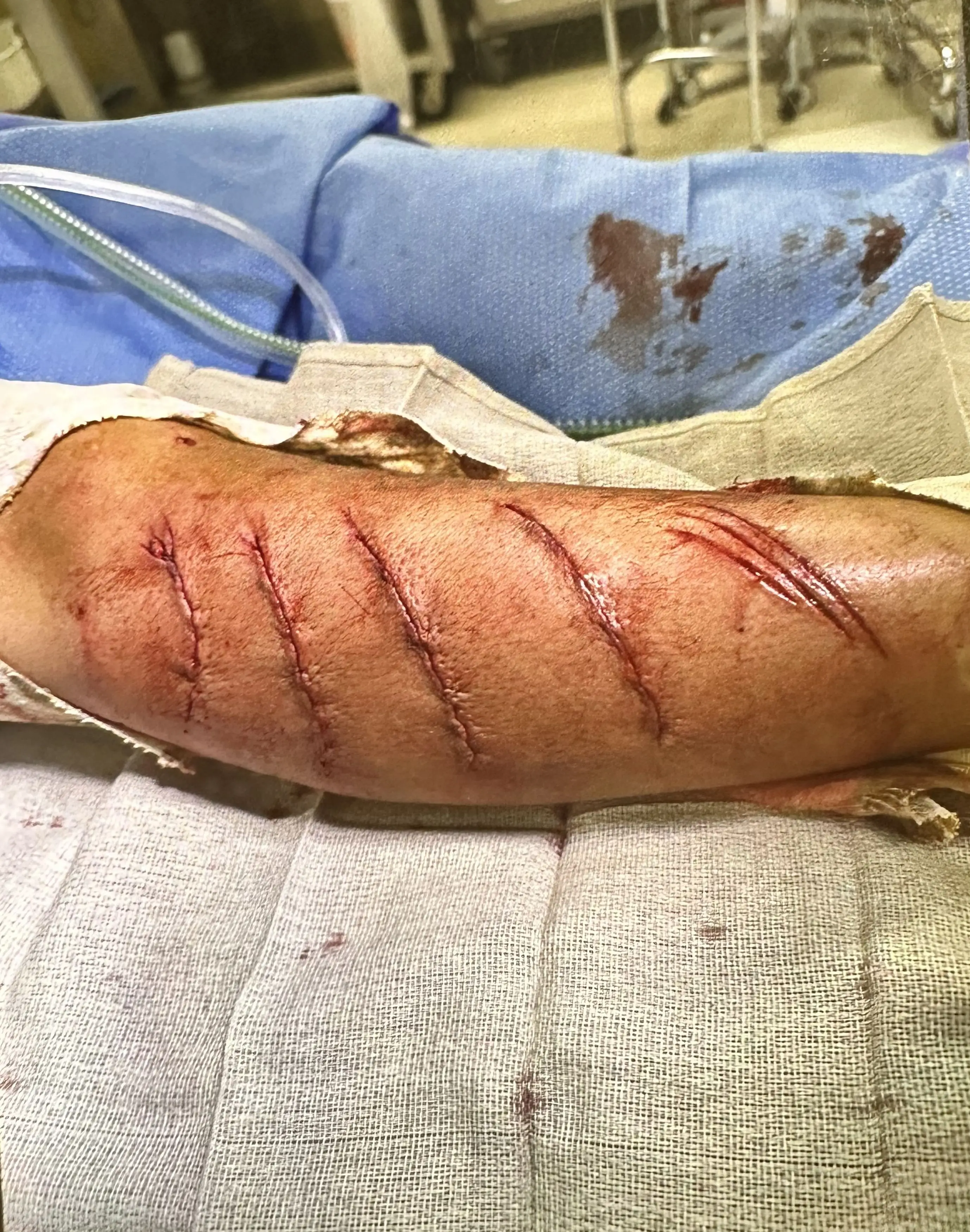 The boy's leg got sucked into a boat propeller in Montana, US (Kennedy News and Media)