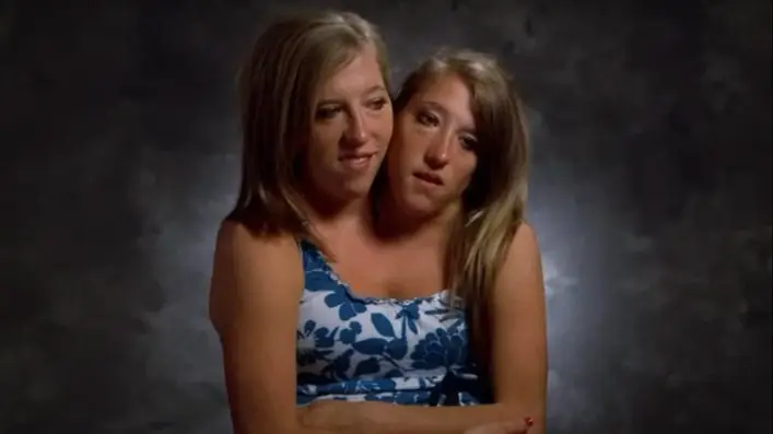Conjoined twins Abby and Brittany Hensel answered what everyone wanted to know about lives