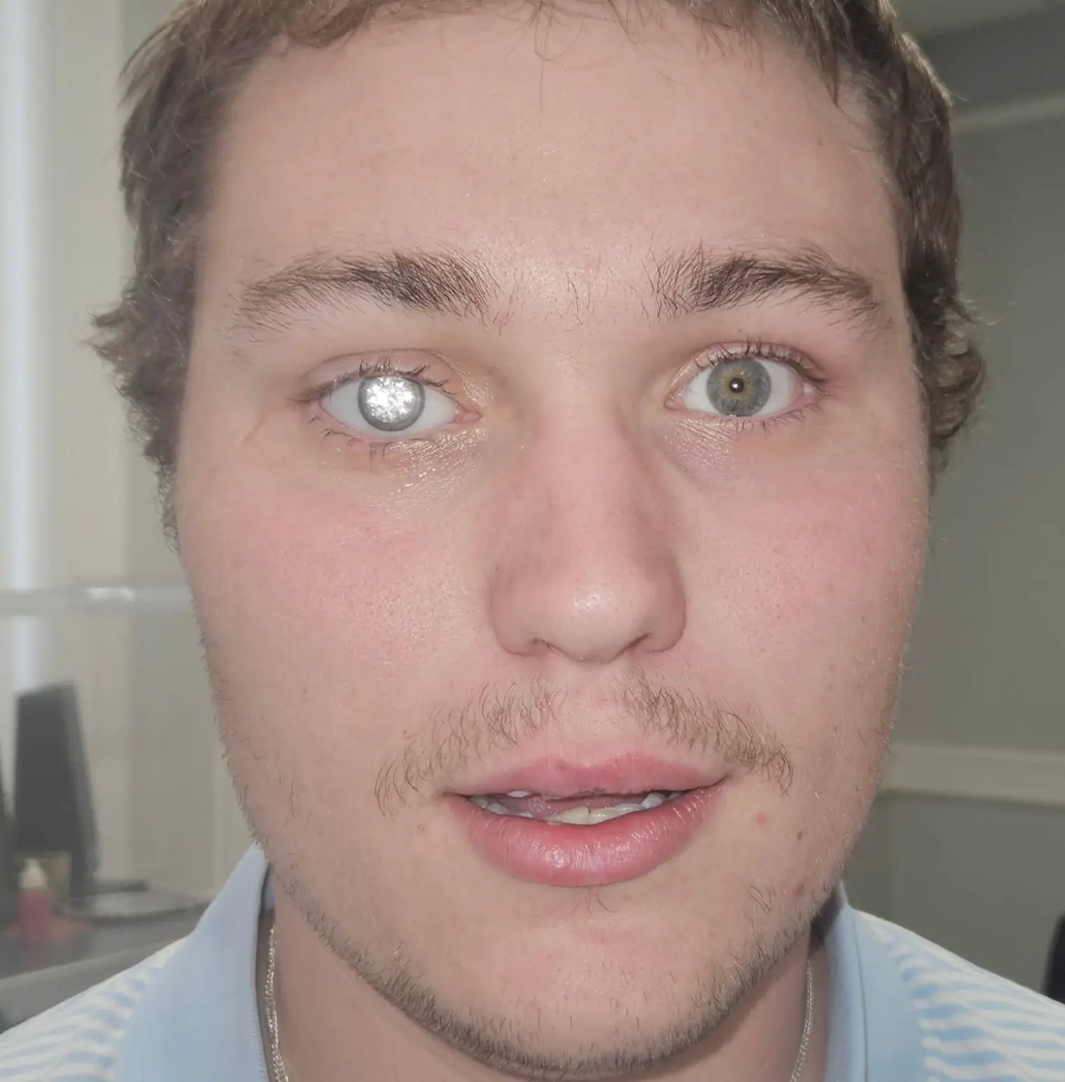 Th pricey accessory set him back $2 million (Instagram/artificialeyesbyjohnimm)