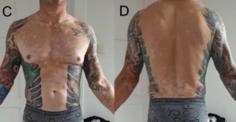 It was noted that he got inked two years before EU restrictions were introduced (Mateuszczyk MK et. al (2025))