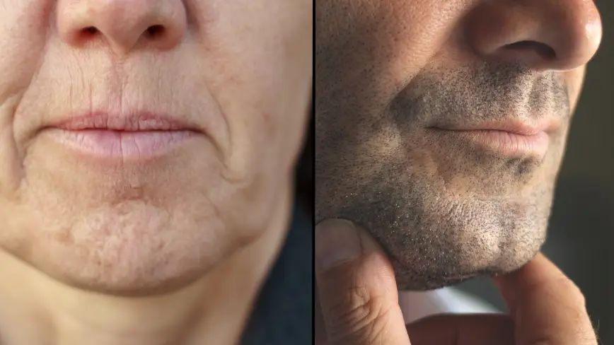 People are getting very upset after learning what chin dimples are