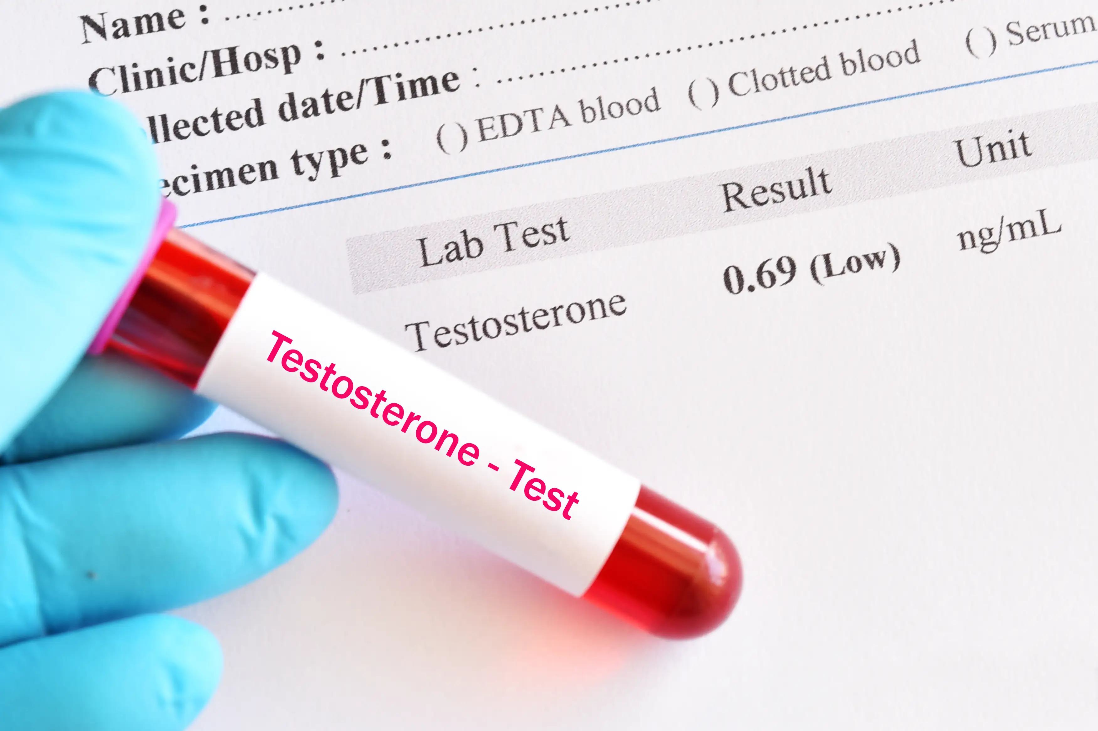 What is low testosterone, and what are the signs? (Getty Stock Images)