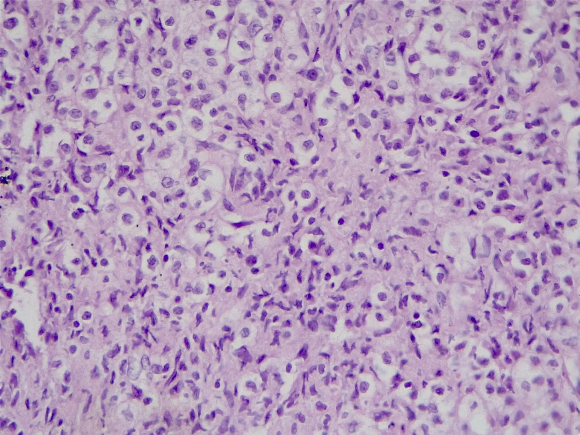 One Swedish study suggested a small link between tattoos and cancer of the lymphatic system (Getty Stock Images)