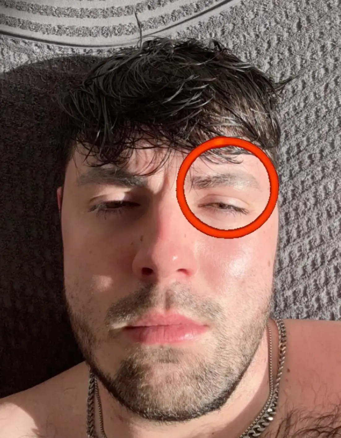 Ruben Chorlton-Owen is raising awareness of trichotillomania (TTM) (Supplied)