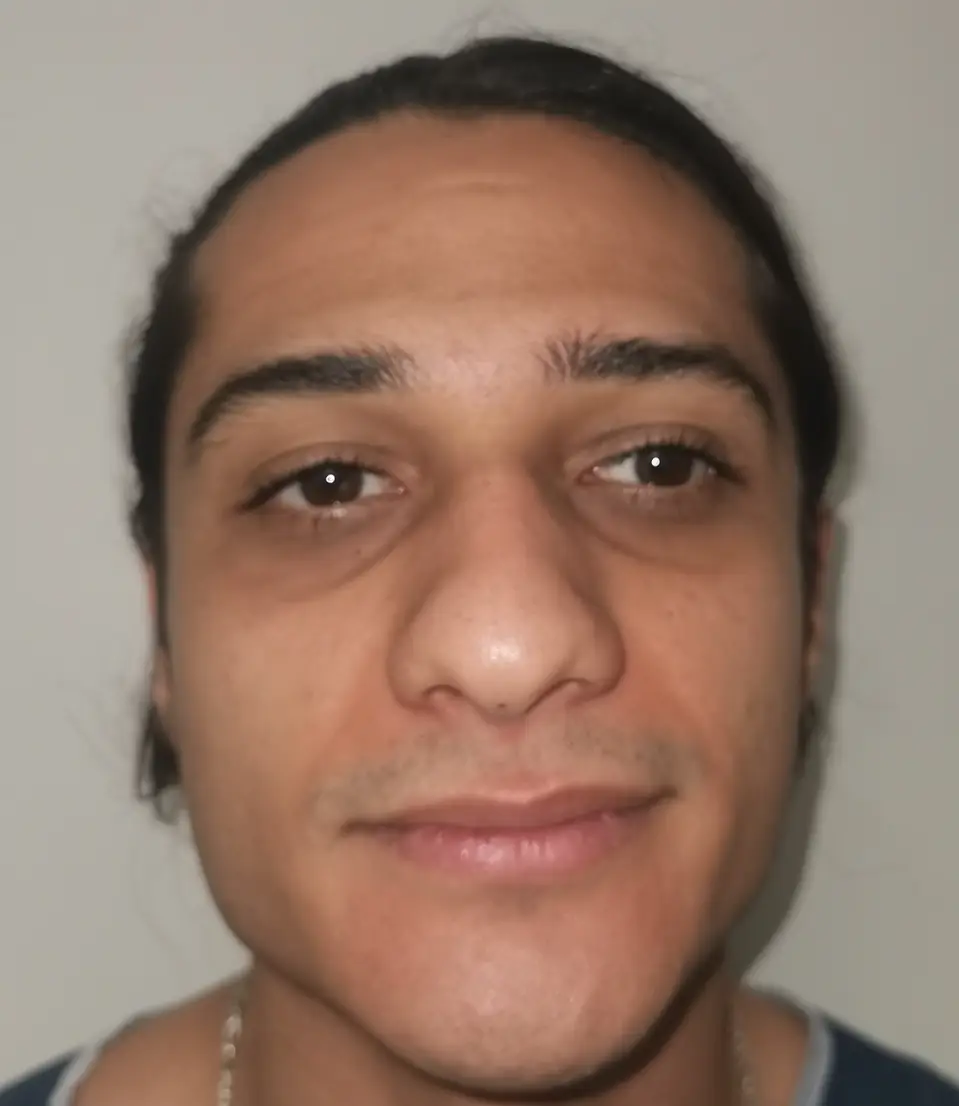 This is what the man looked like before... (Instagram/@esteistanbultr)