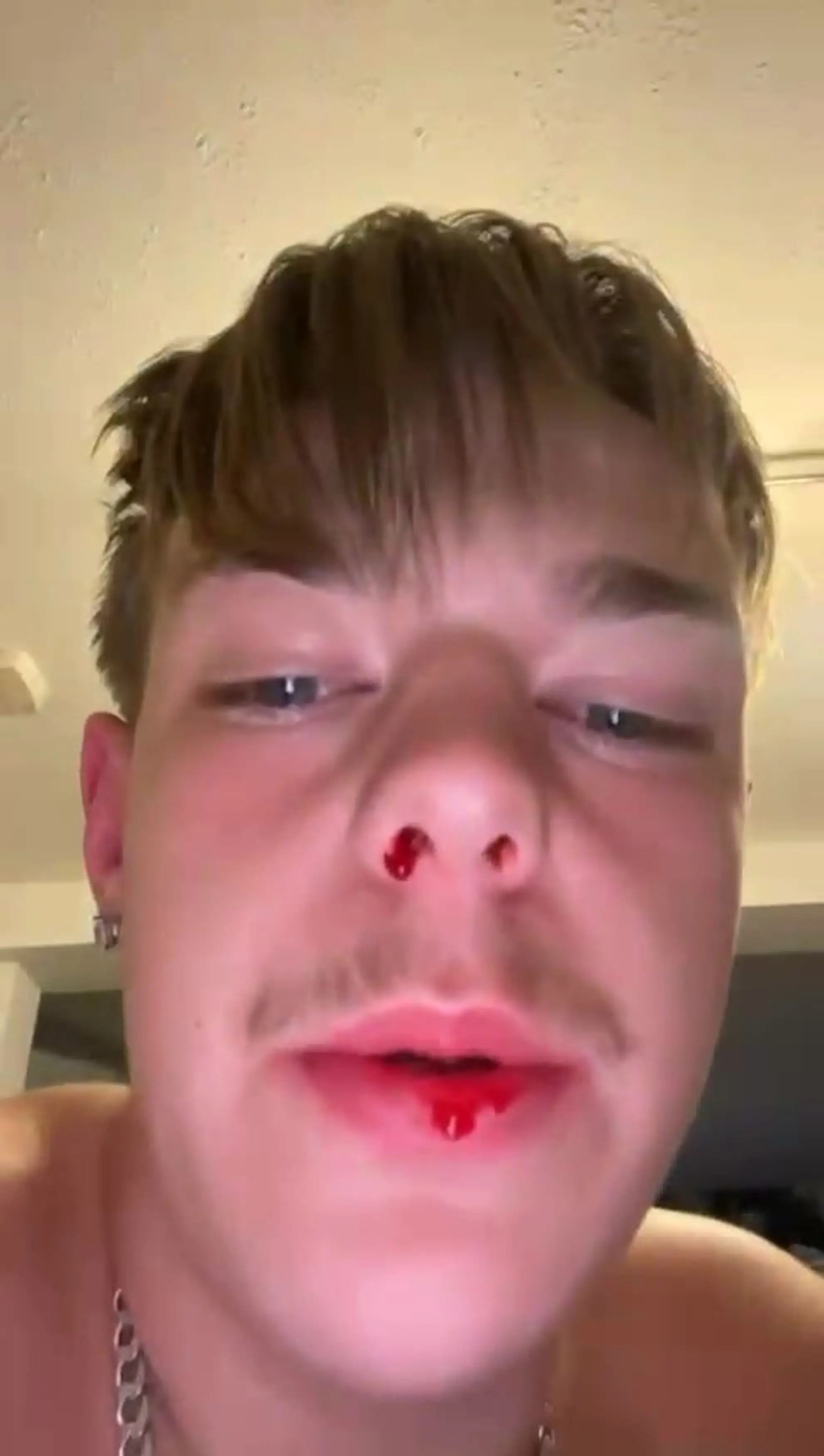 He was coughing up 'pints' of blood while on holiday. (Kennedy News and Media)