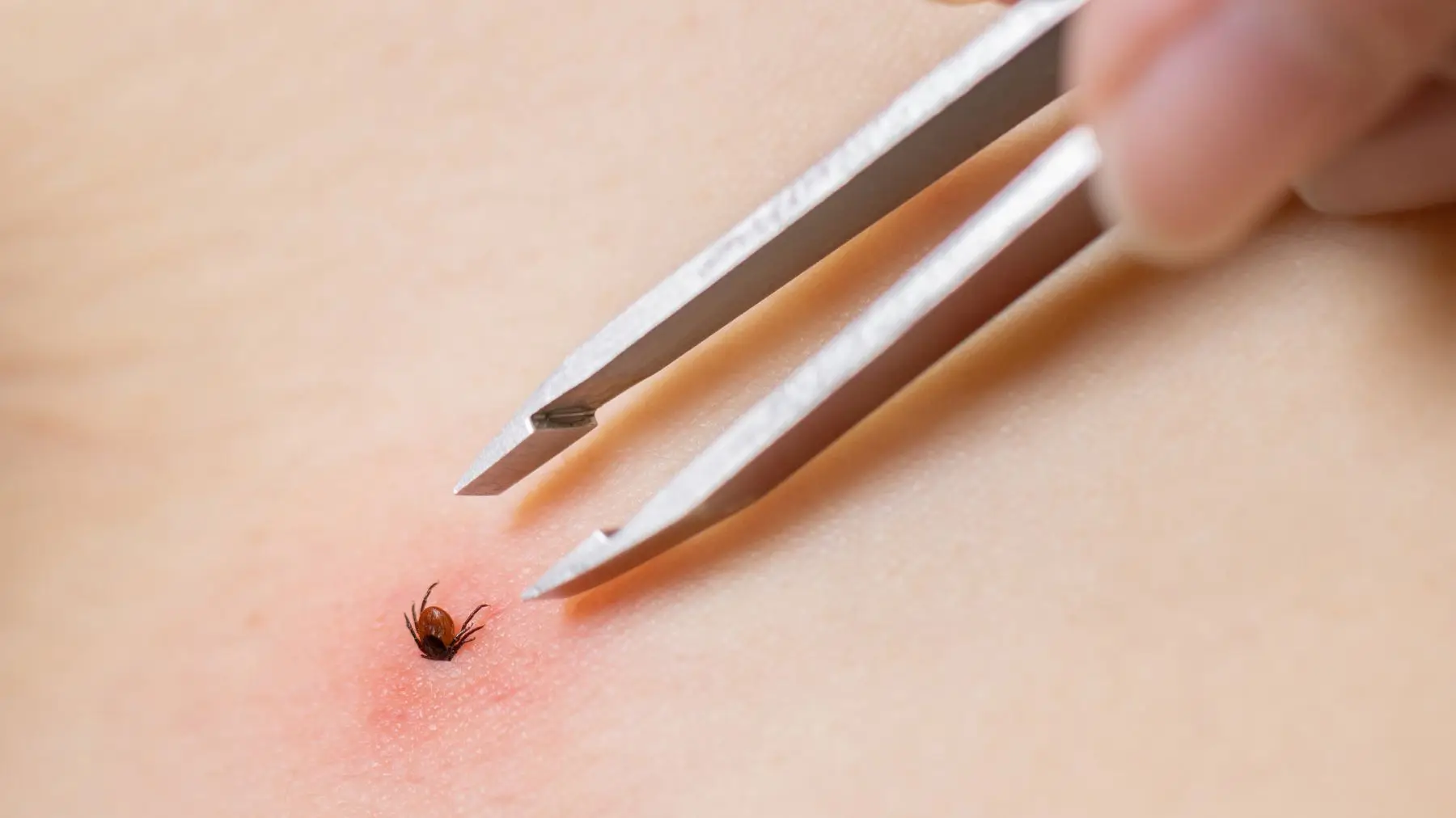 It's really important to remove ticks properly (Rbkomar/Getty Images)