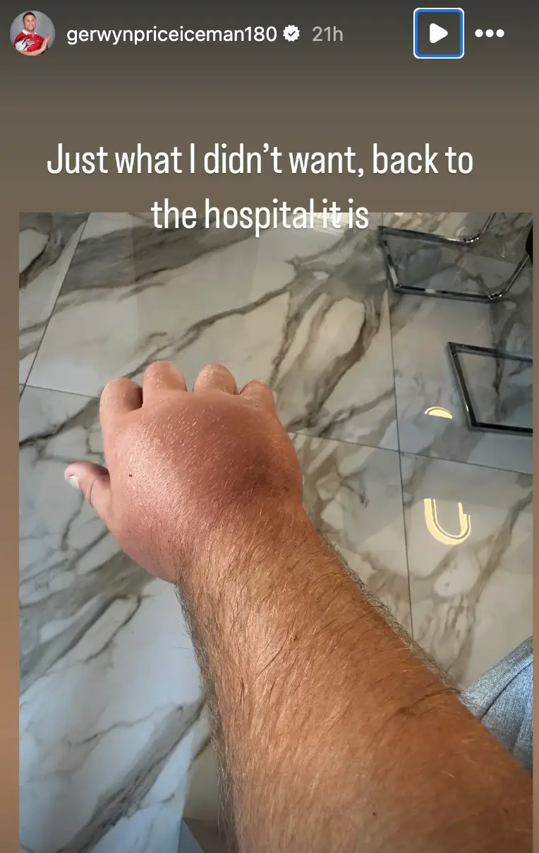 Price posted a picture of his swollen hand on Instagram. Image credit: gerwynpriceiceman180