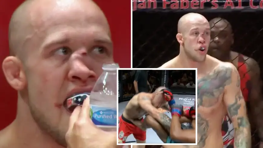 MMA Fighter Suffers Horrific Nose Disfigurement After Copping Brutal Knee Strike