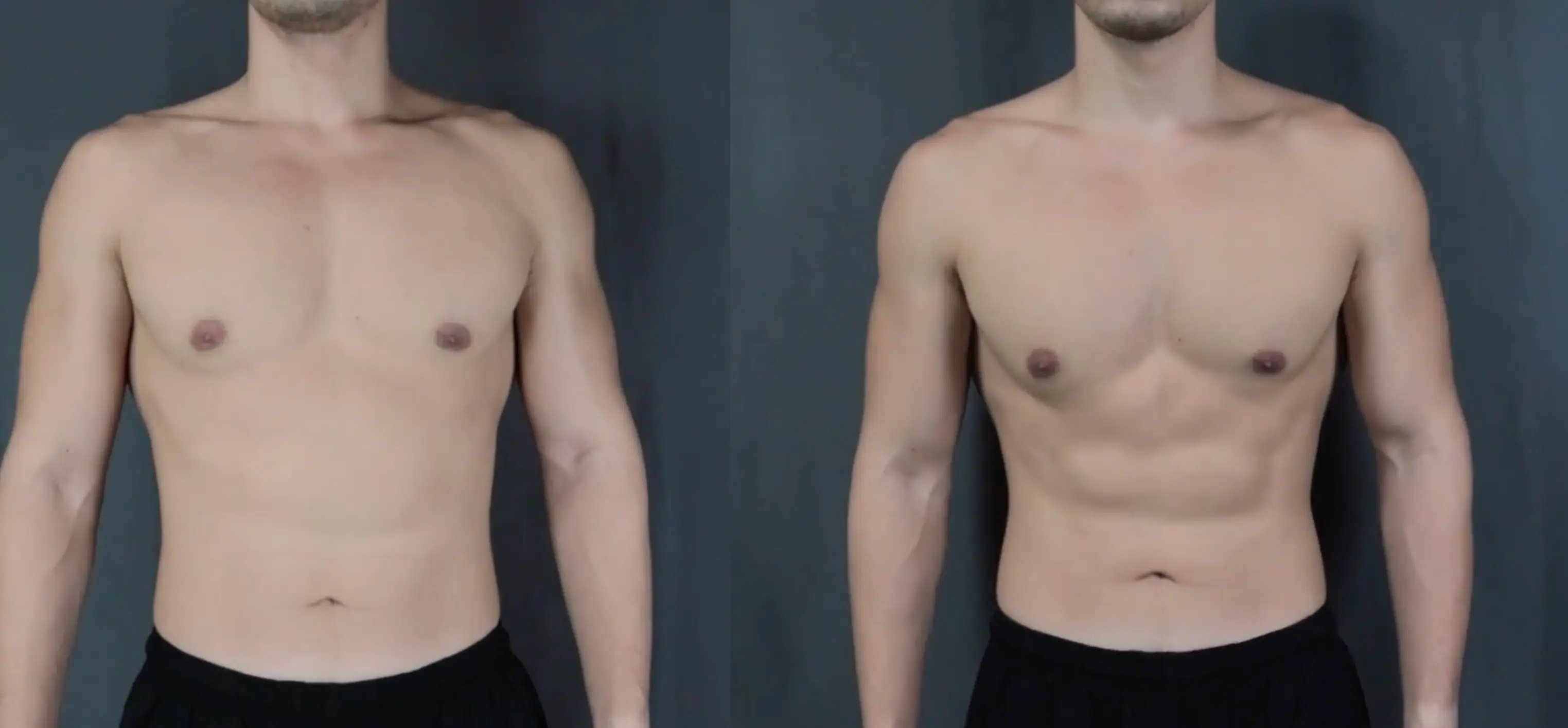 Your Average Gent's results afte 30 days (Credit:YourAverageGent/YouTube)