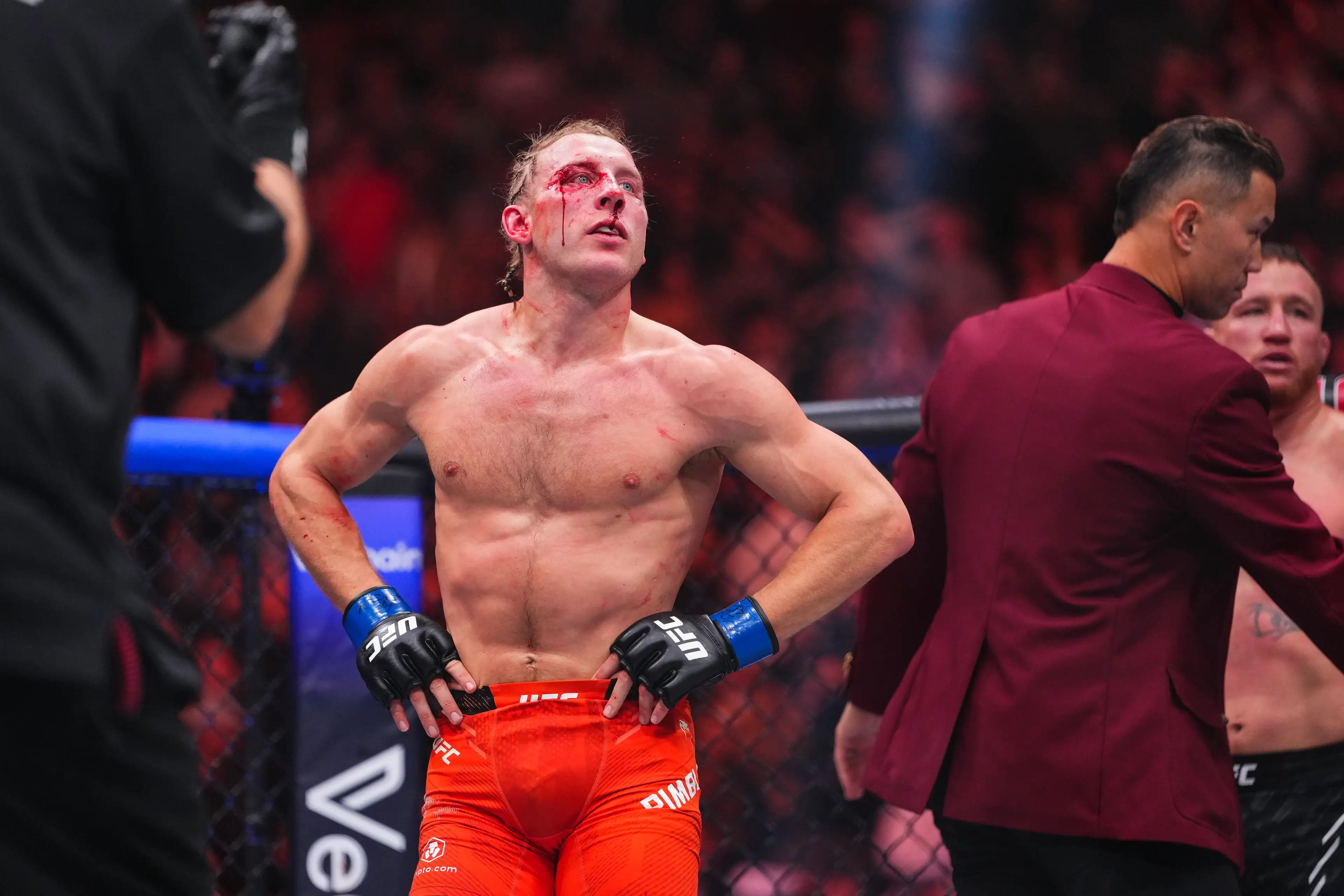 Paddy Pimblett is set to serve a medical suspension following UFC 324. Image: Getty 
