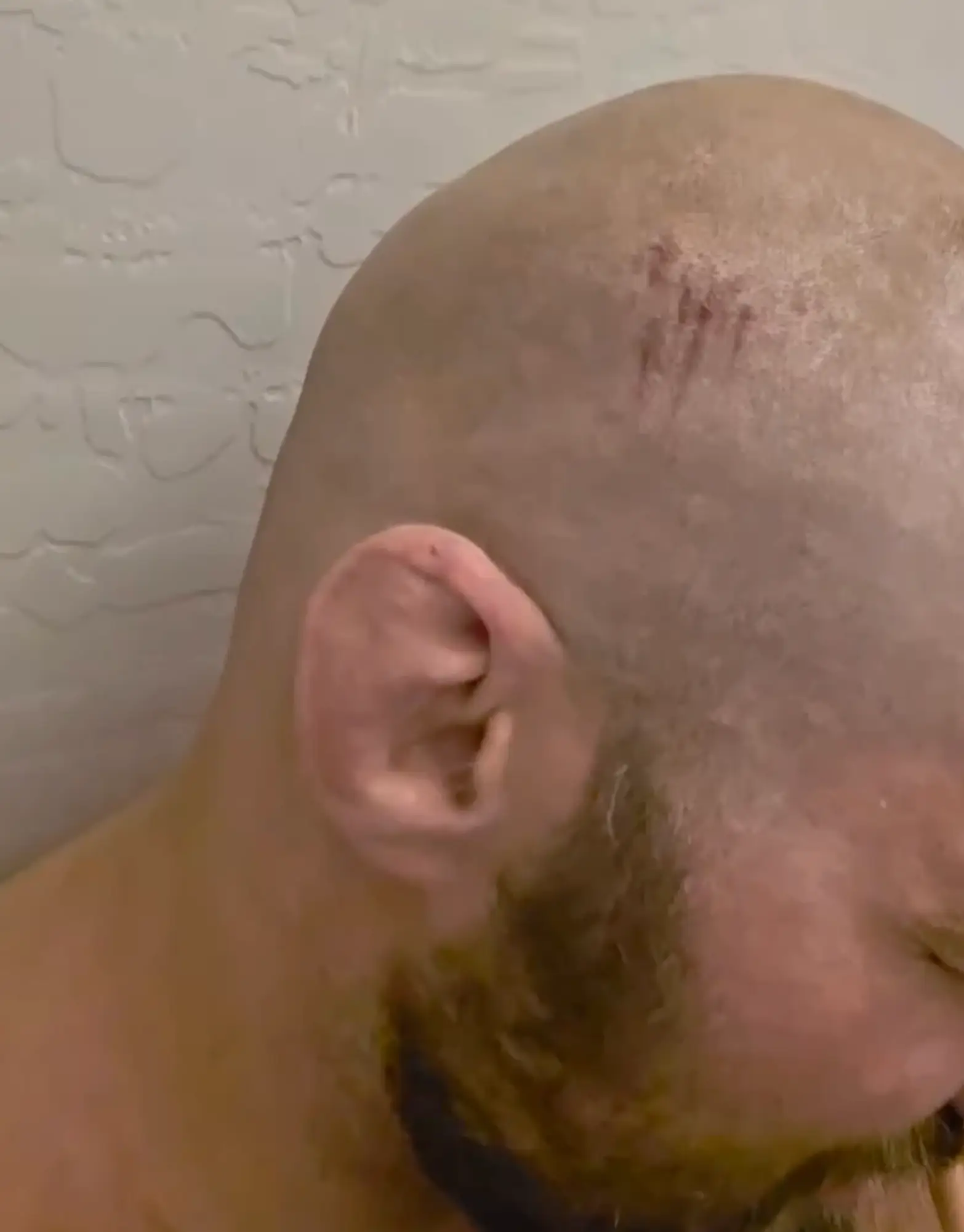 Sean Strickland grazed his head during the crash (Credit:Sean Strickland)