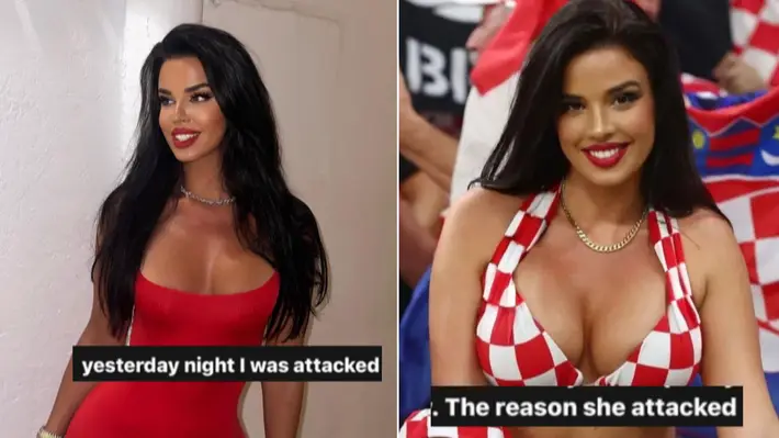 Ivana Knoll claims she was attacked during holiday to Mykonos