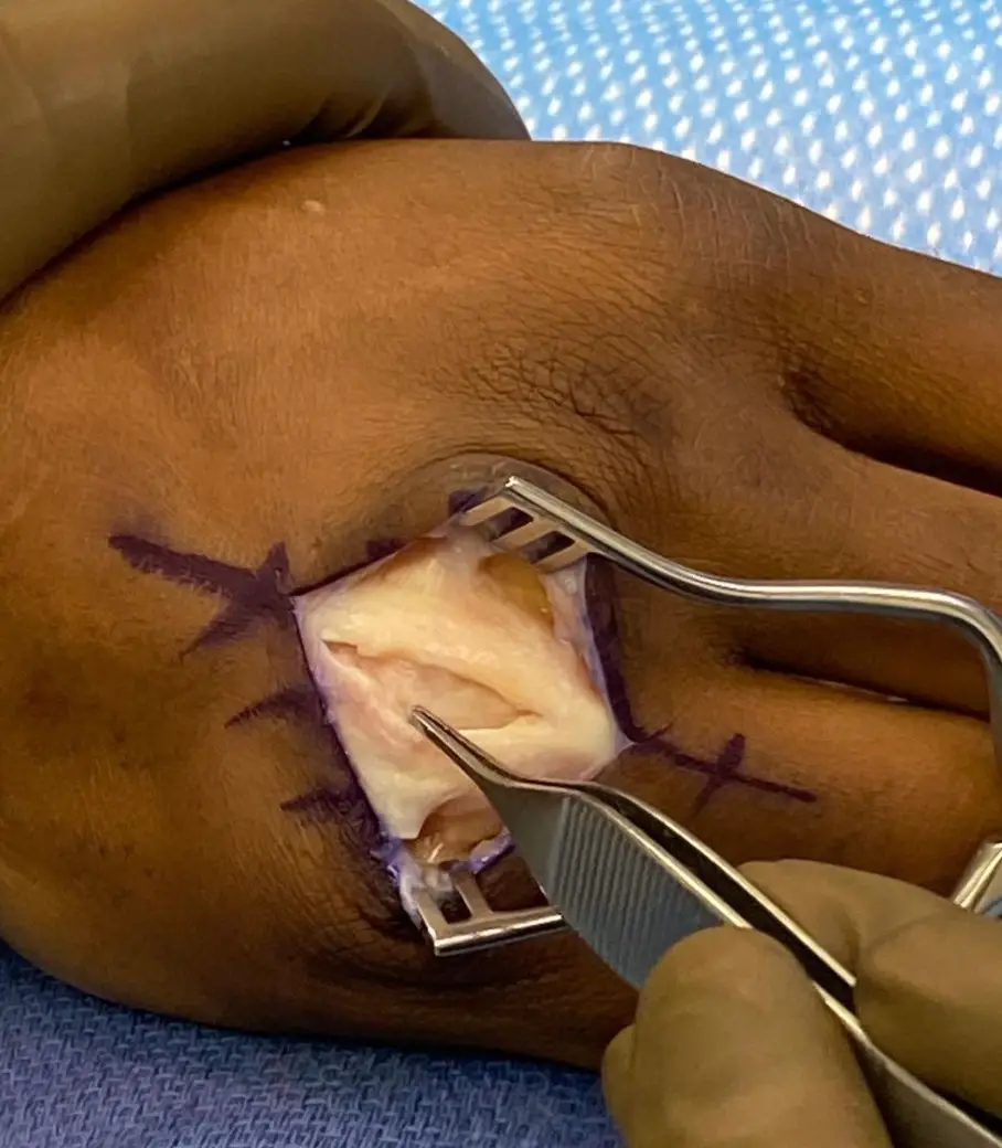 Dana White revealed Usman has undergone hand surgery (Image: Instagram/DanaWhite)