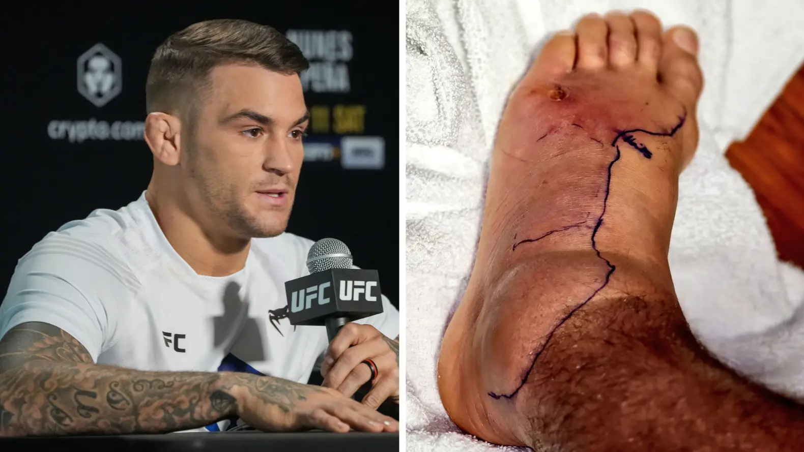 Px Images / Alamy.  @DustinPoirier/Twitter.