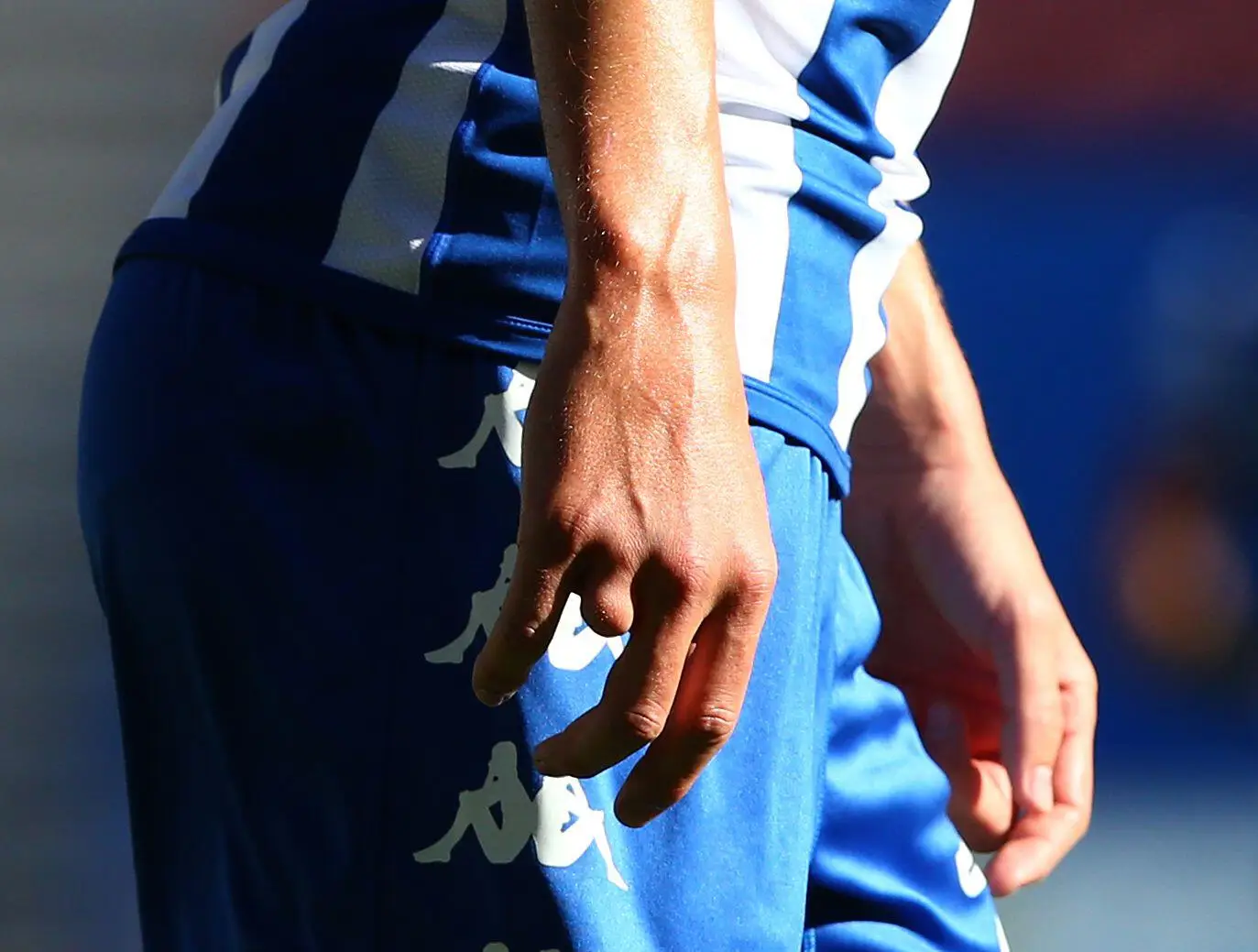 Burn's missing finger during his Wigan days. Image: PA Images