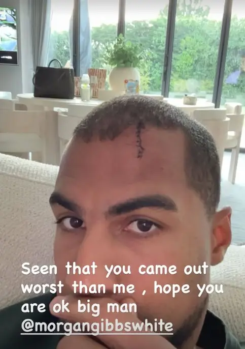 Screenshot of Robert Sanchez from his Instagram of his cut to his head.