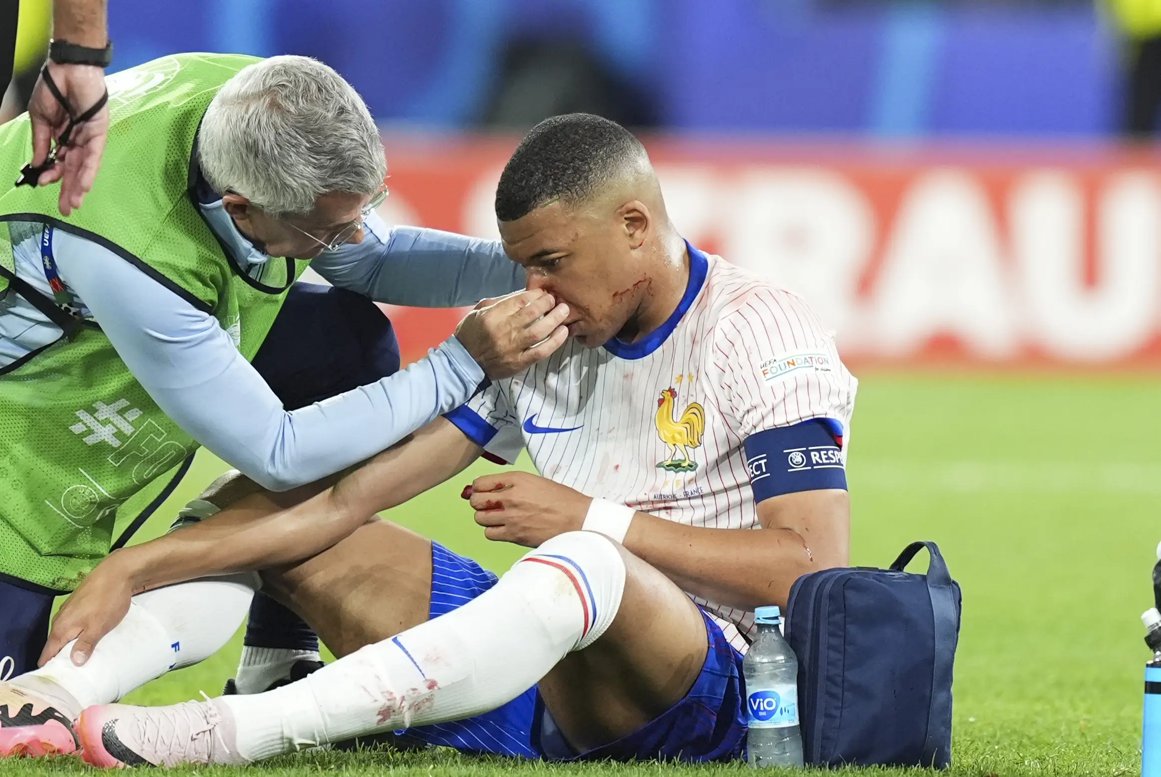 Kylian Mbappe receives treatment on his nose. Image: Getty 