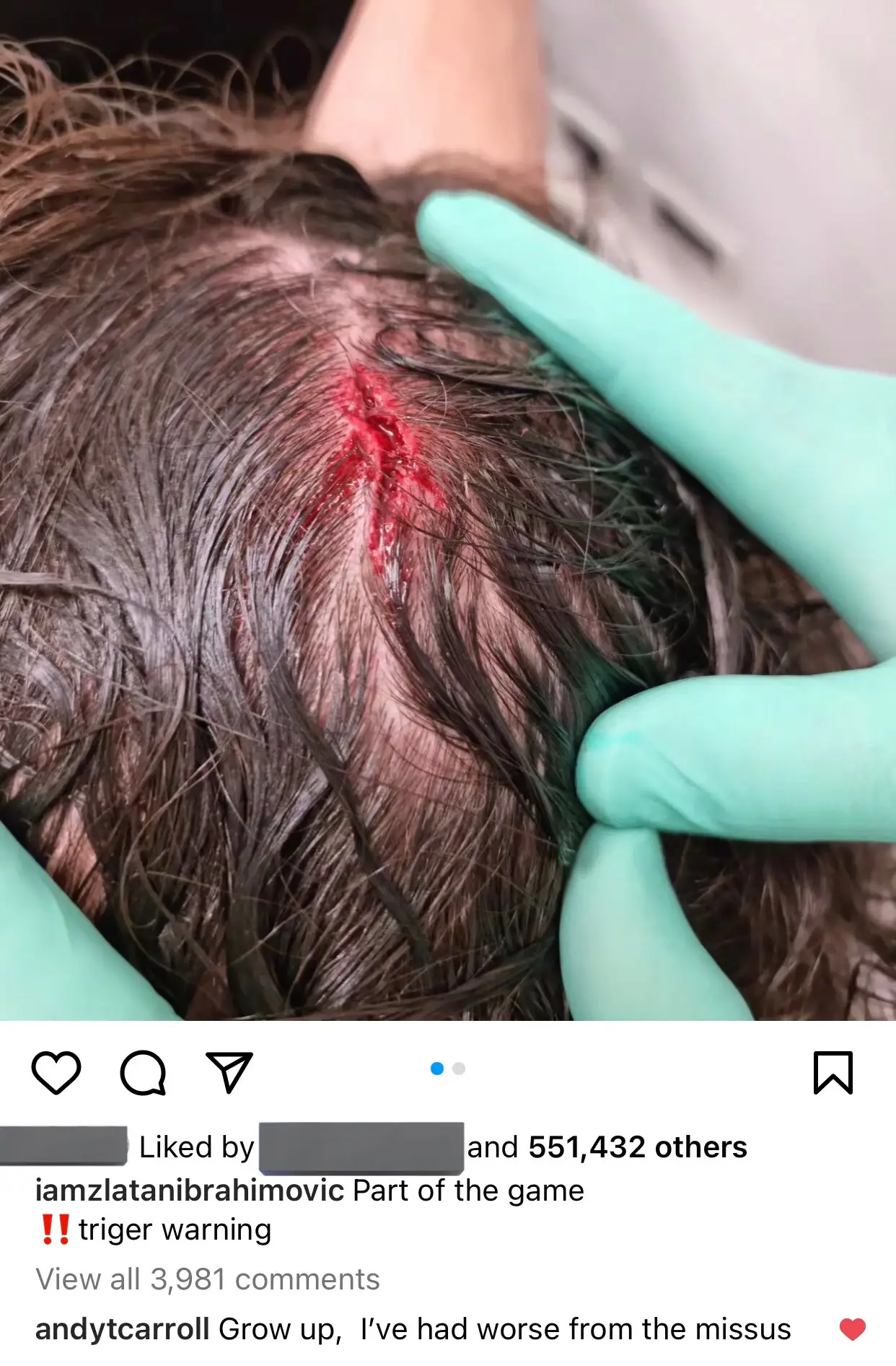 Ibra's Instagram post (Credit:Zlatan Ibrahimovic)