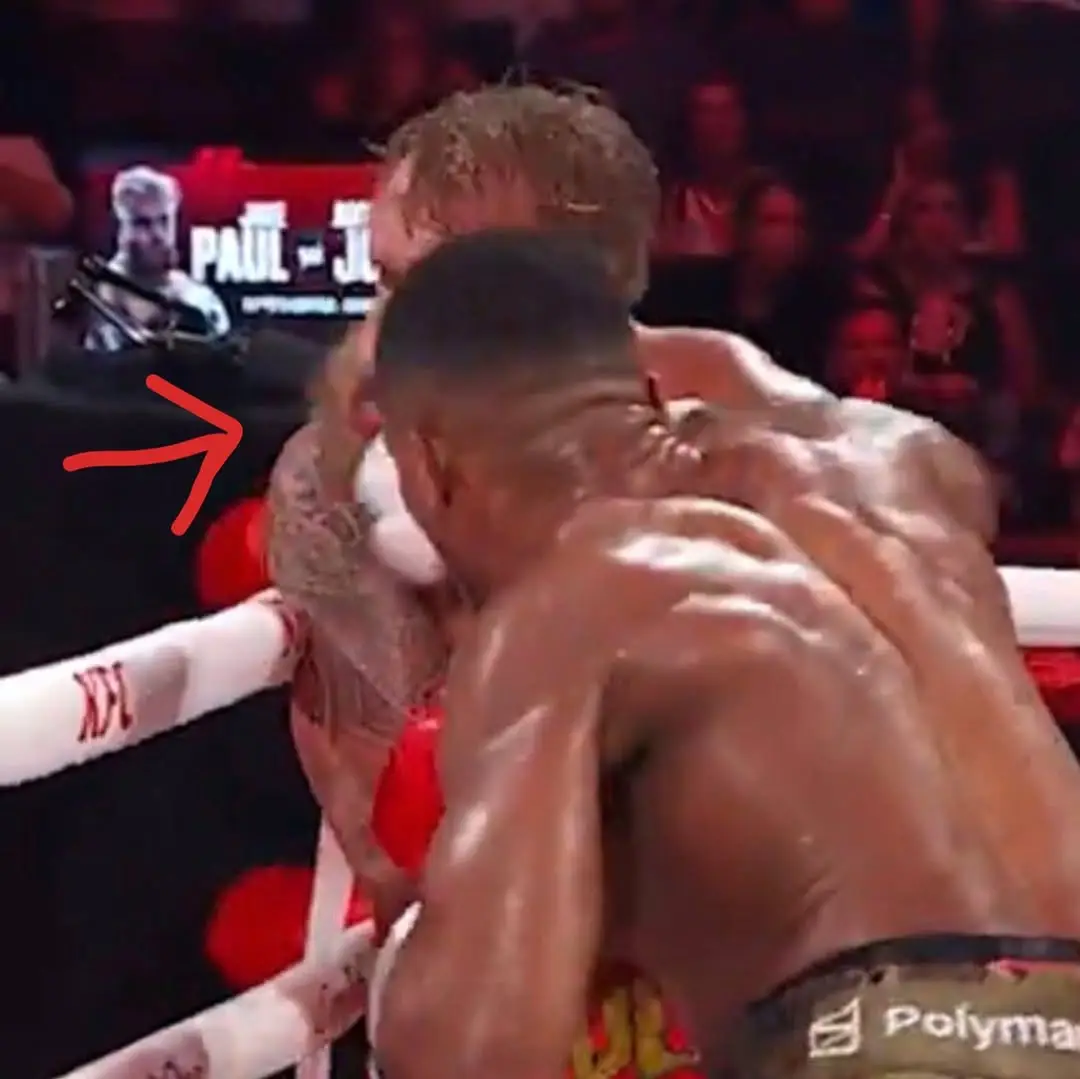 Paul posted a picture of his seemingly broken jaw after the punch from Joshua. Image credit: Instagram/jakepaul