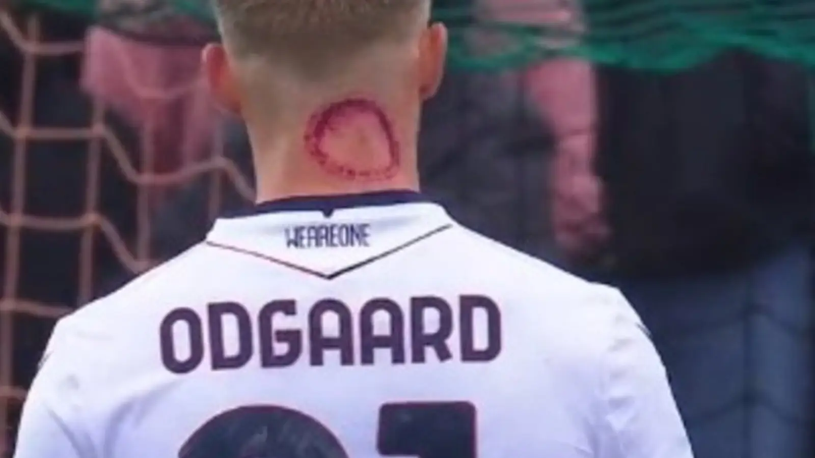 Serie A player forced to release statement after 'zombie bite' injury goes viral