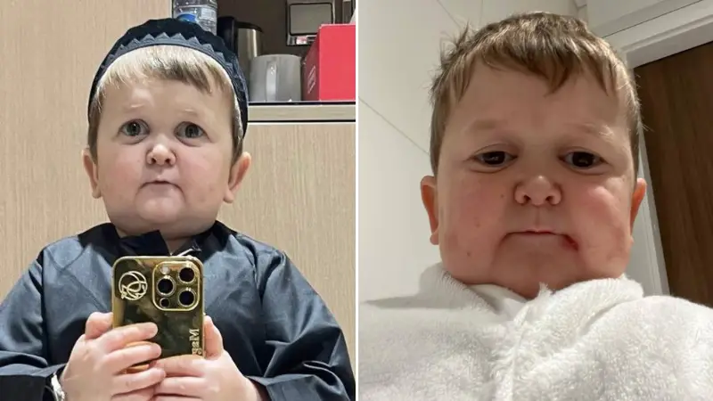 Hasbulla Will Refuse To Pose With Female Fans On Upcoming Tour