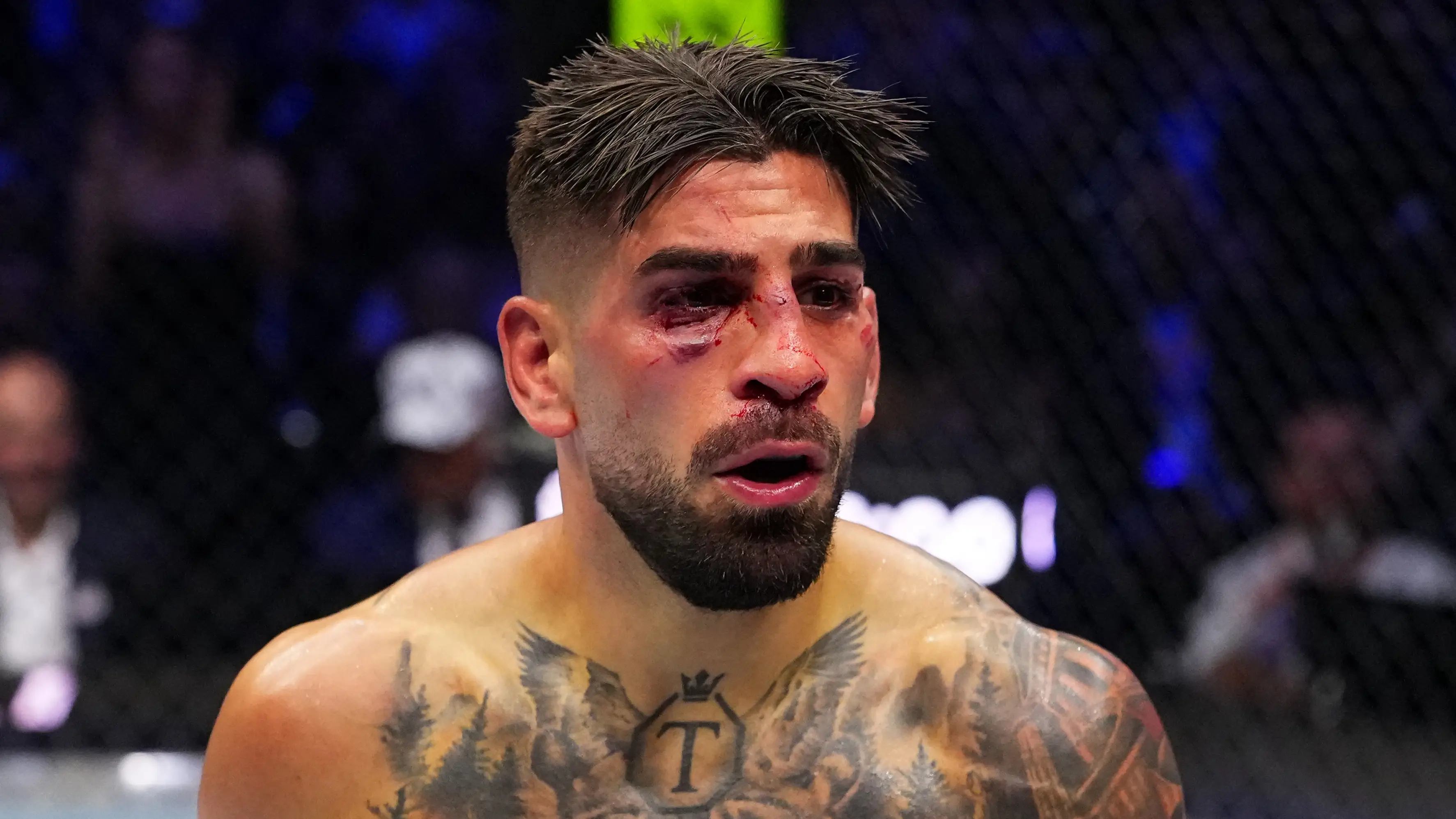 Jeff Bottari / Contributor (Getty)