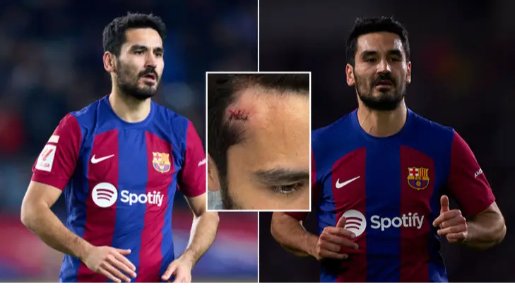 Getty / Instagram/@saraguendogan