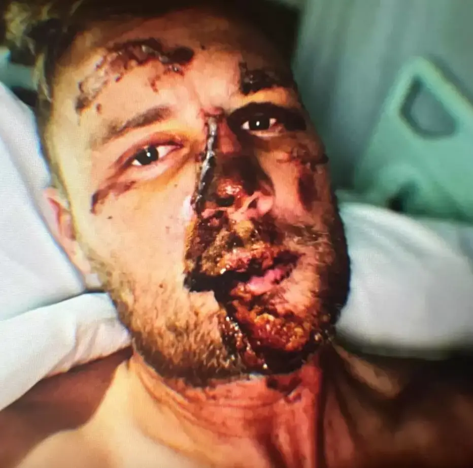 Freddie Flintoff thought he 'was dead' in the immediate aftermath. Image: Disney+