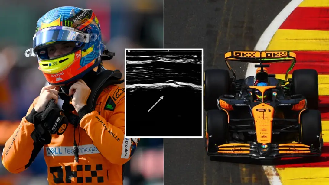 F1 star reveals he drove with 'serious injury' for 'at least' three races after x-ray result kept under wraps 
