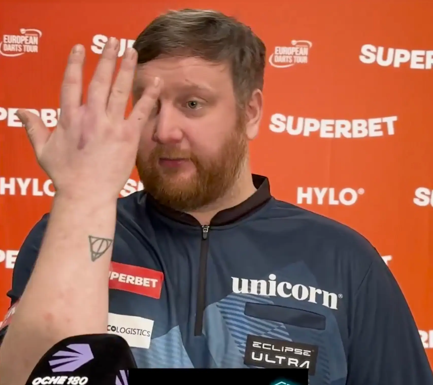 Menzies shows camera his hand injury. Image credit: Oche180/X