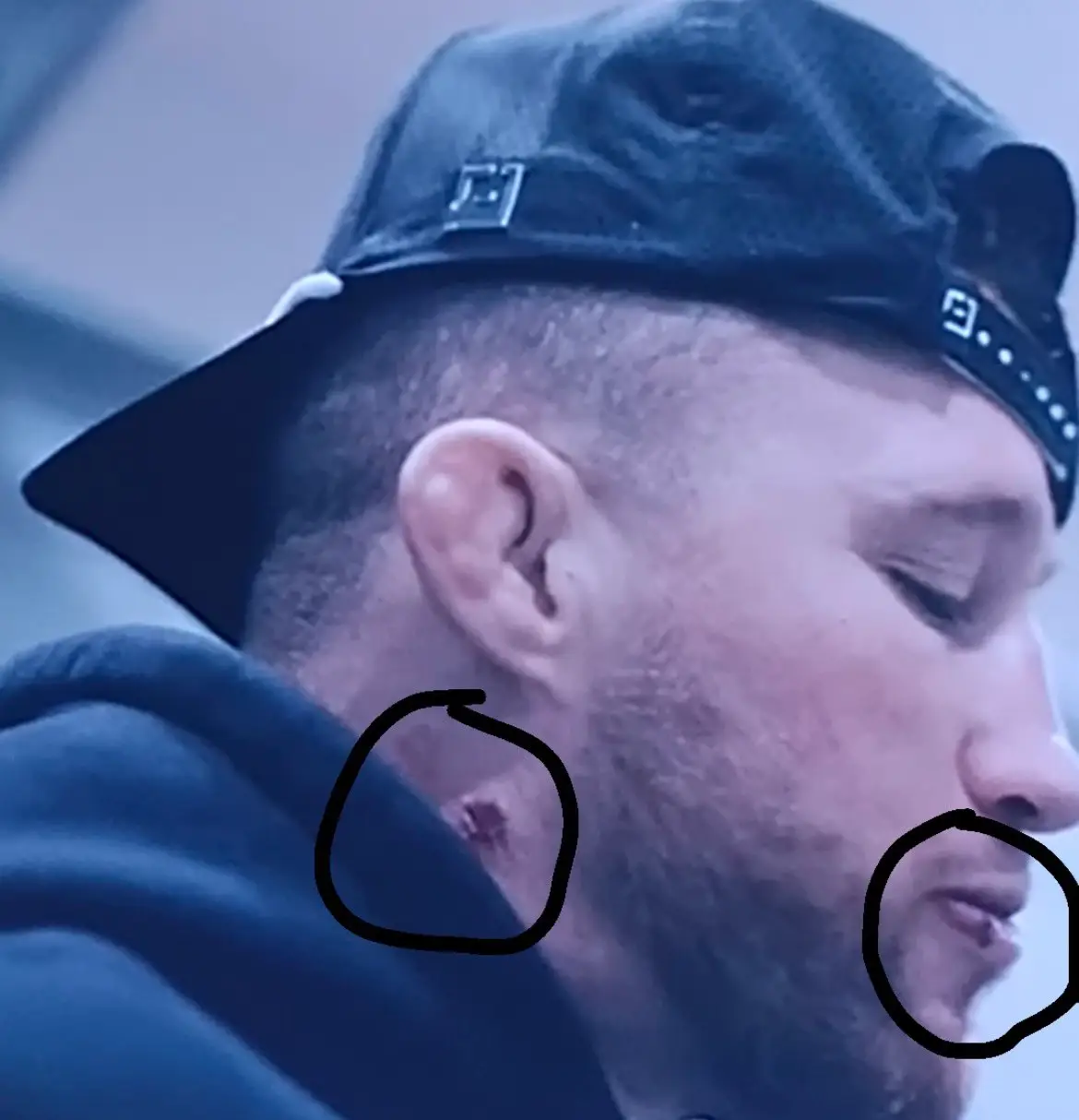 This image of Justin Gaethje emerged on social media, sparking injury concerns. Image: X/@DovySimuMMA