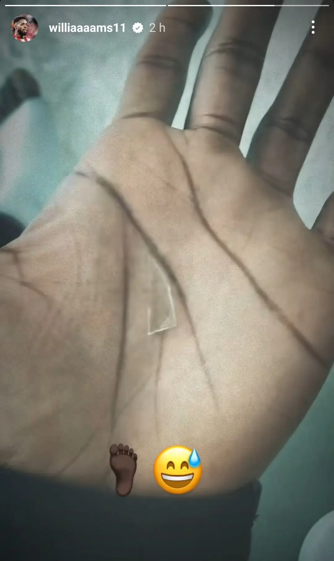 Williams shared a picture of the glass on his Instagram after having surgery. Image credit: @williaaaams11