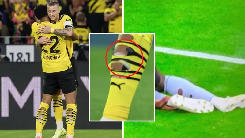 Fans are confused by massive holes in Jude Bellingham's socks - but there's a very good reason