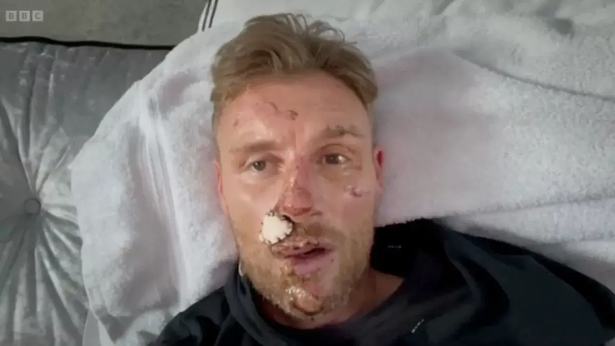 Former Top Gear host Freddie Flintoff crashed while filming the show in December 2022. (Image: BBC)