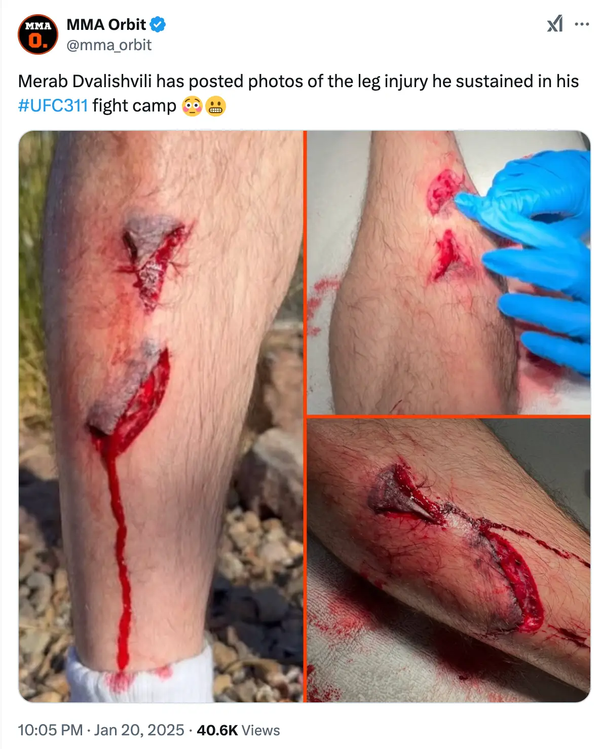 Merab Dvalishvili nearly had his leg amputated ahead of his title defence at UFC 311. (Image: MMA Orbit) 