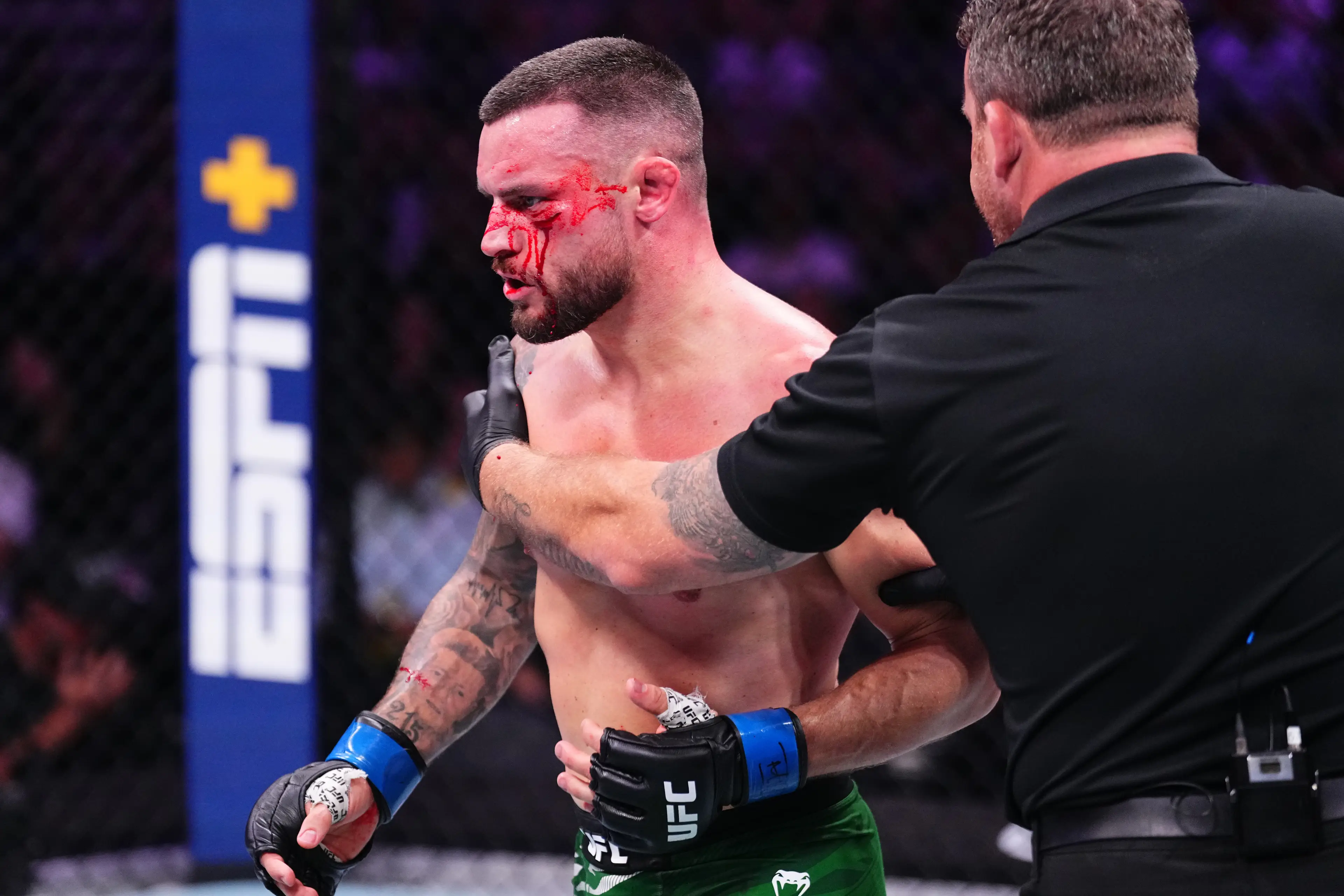 Kiefer Crosbie absorbed an illegal knee before losing to Taiyilake Nueraji. Image: Getty