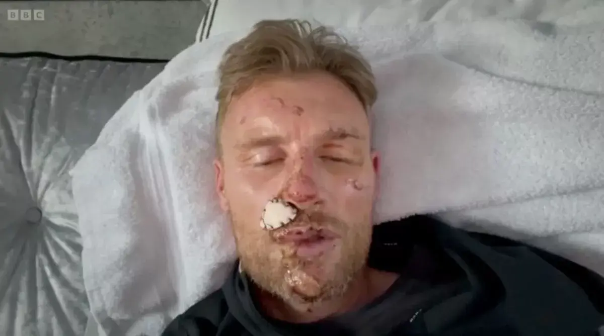 Flintoff's crash left him housebound due to his injuries and the anxiety caused by them. (Image: BBC)