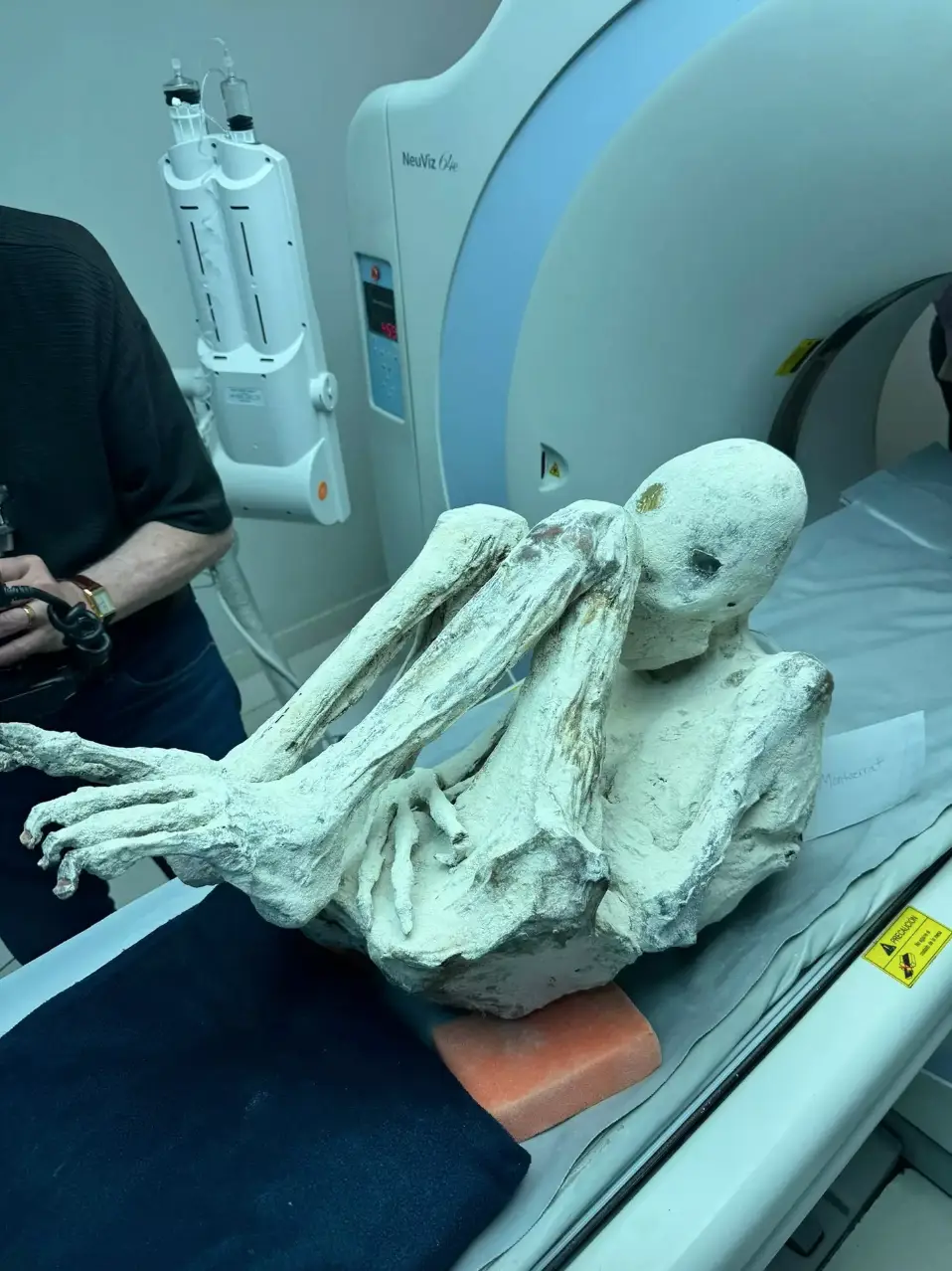 Peru has seen a spike in grave-robbing at the site where a three-fingered 'alien mummy' was found (X/@pikespeaklaw)