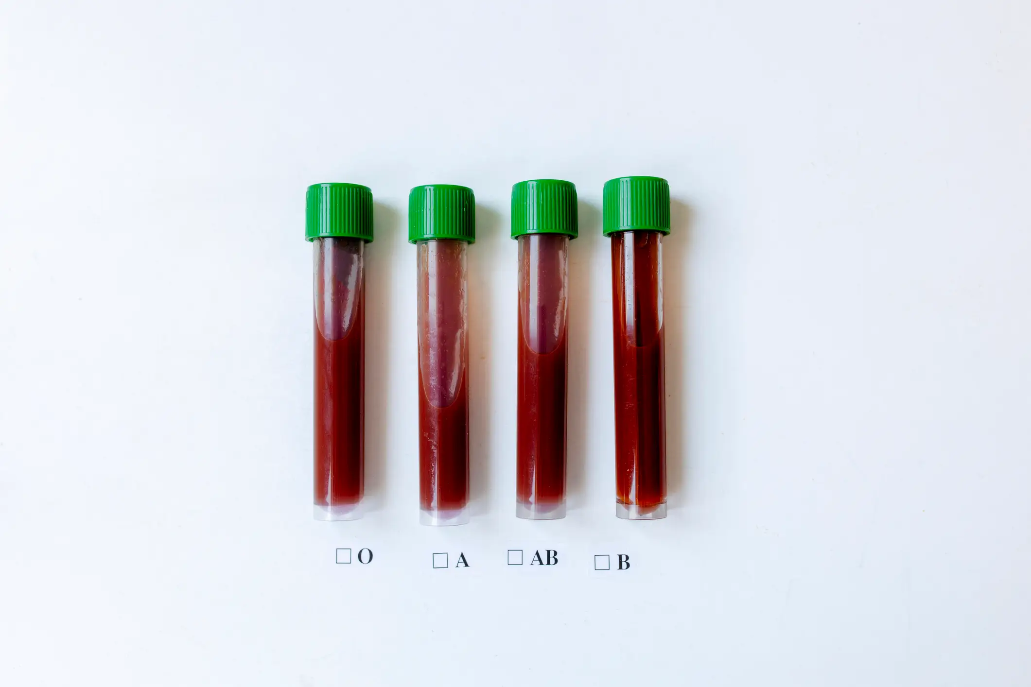 The eight humans blood types are A+, A-, B+, B-, AB+, AB-, O+, and O- (Westend61/Getty)