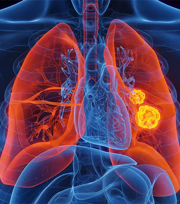 SEBASTIAN KAULITZKI/SCIENCE PHOTO LIBRARY / Getty