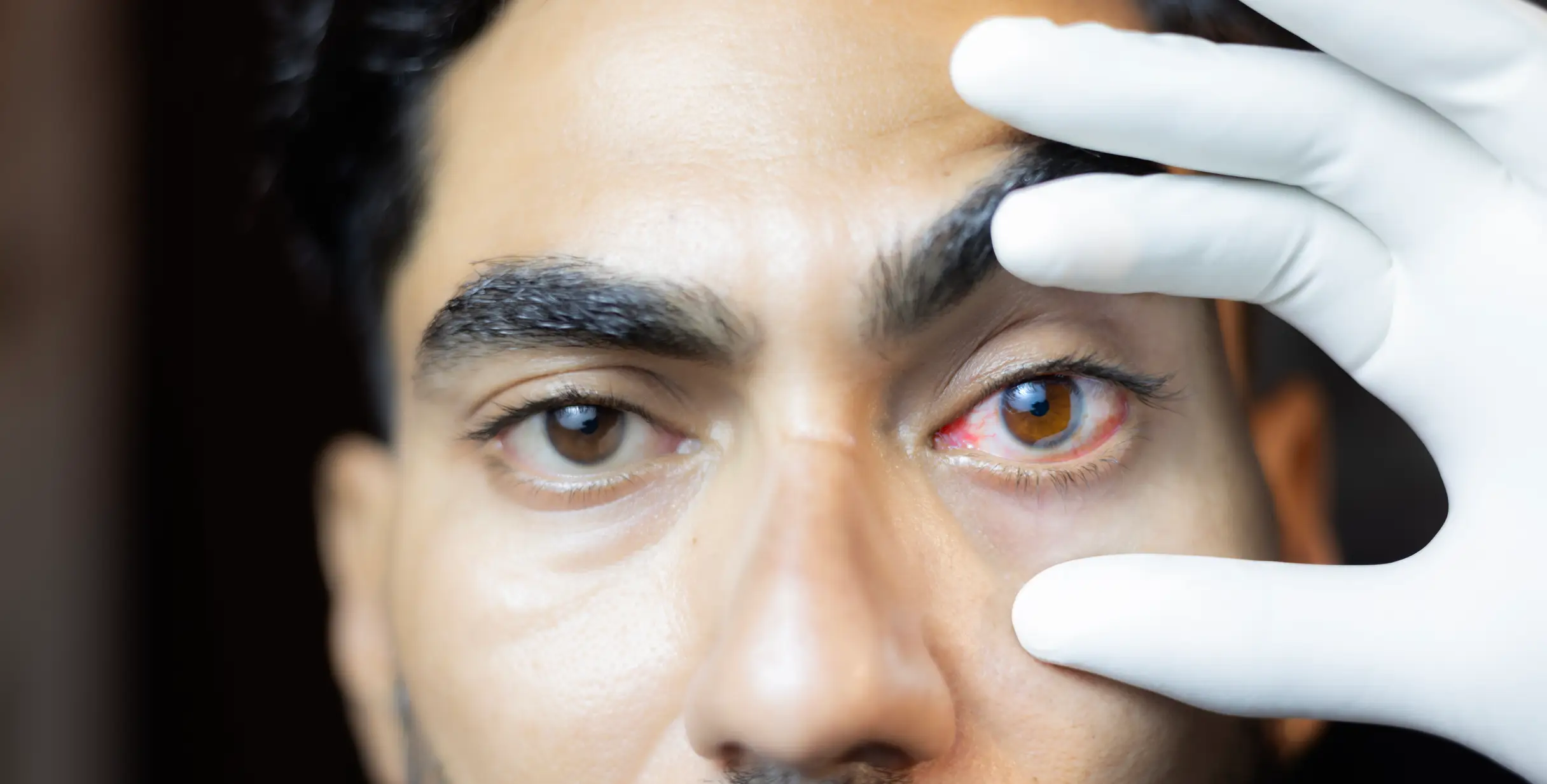 The AI tool can provide a survival analysis from the appearance of the area under the eyes and around the bridge of the nose (Uma Shankar sharma/Getty Images)