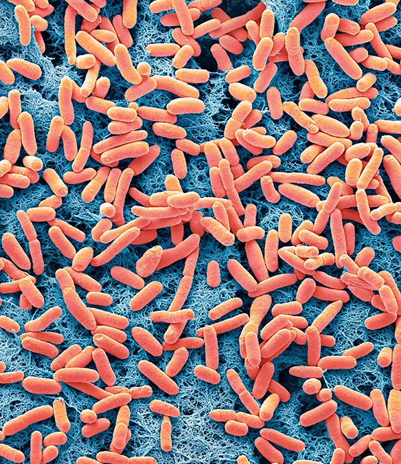 Zosurabalpin is highly effective at combatting CRAB /Handout/Steve Gschmeissner/Science Photo Library/Getty Images