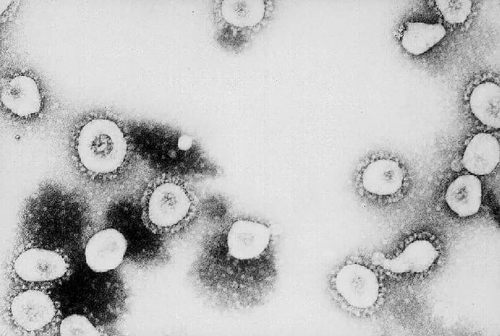 Some have speculated that the COVID-19 pandemic originated in a lab, although a new study challenges that notion with groundbreaking analysis (CDC/Getty Images)