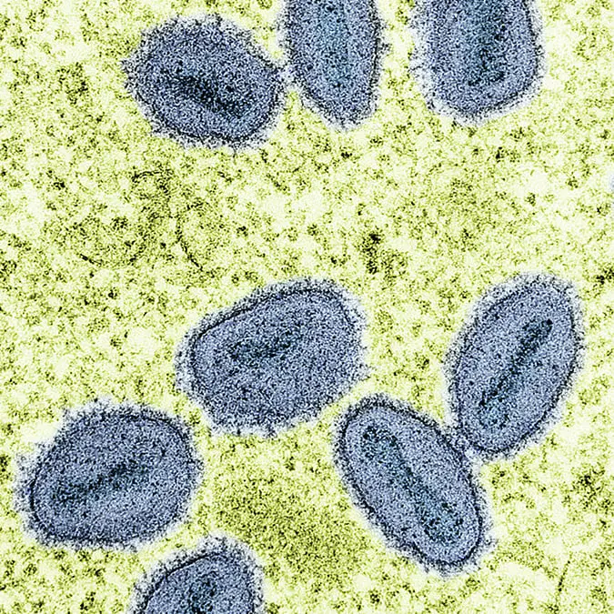 NIH-NIAID/Image Point FR/BSIP/Universal Images Group via Getty Images