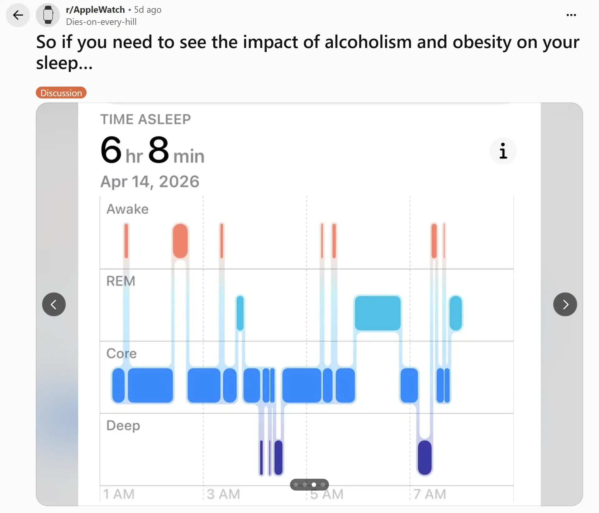 After quitting drinking, core and REM sleep were less fragmented (Dies-on-every-hill/Reddit)