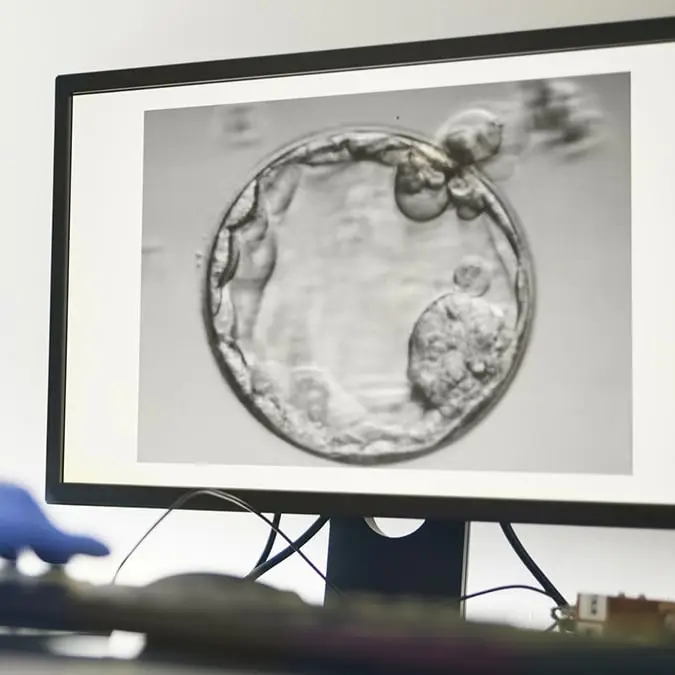 Tempura/Getty Images