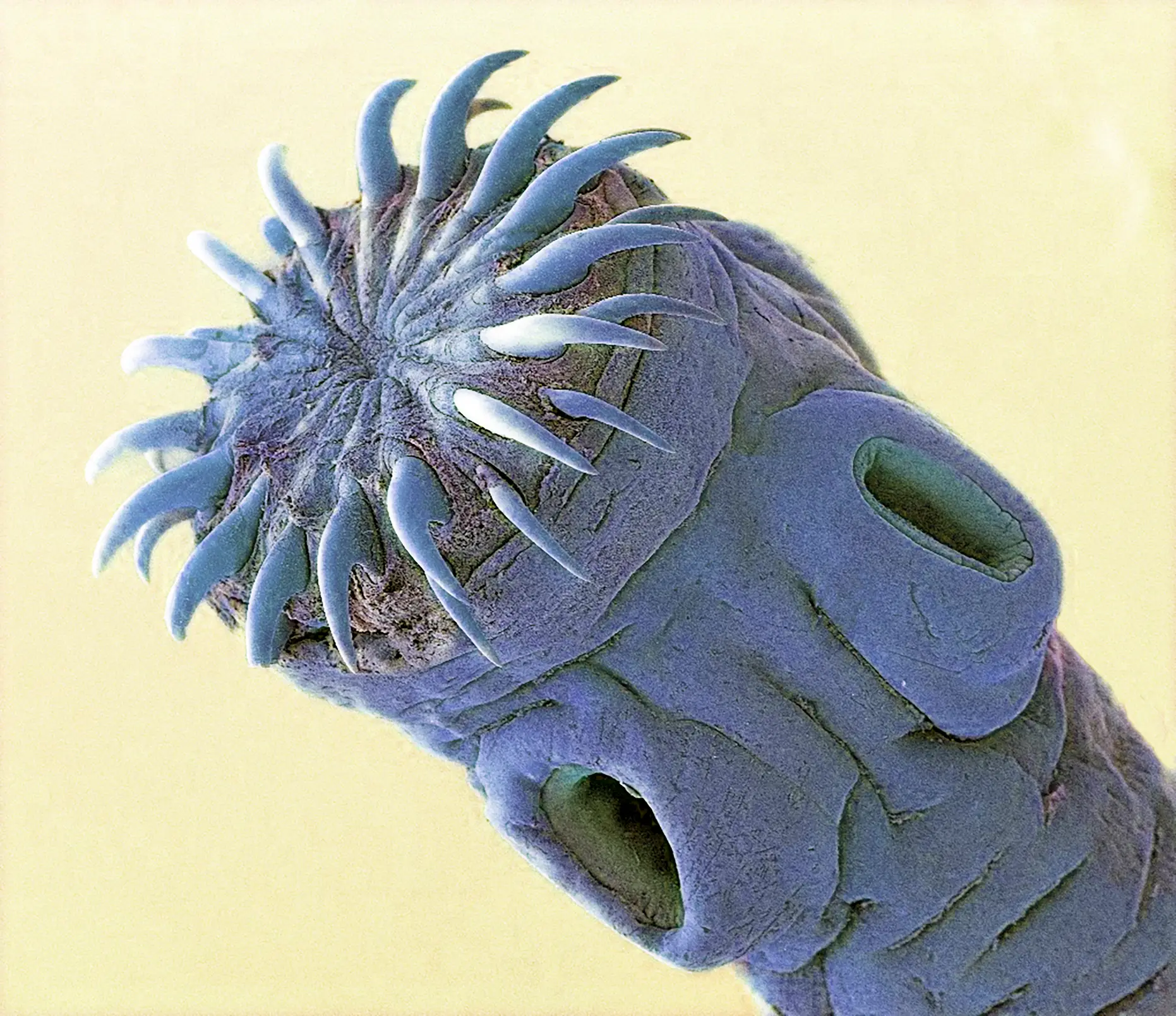 Pork tapeworm releases eggs into various tissues including the brain. (STEVE GSCHMEISSNER/SCIENCE PHOTO LIBRARY/Getty)