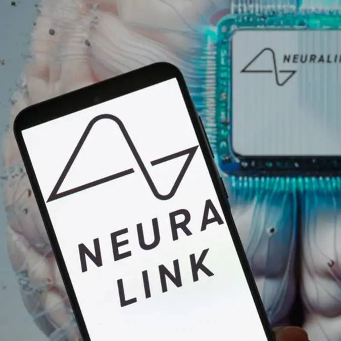 Jonathan Raa/NurPhoto via Getty Images